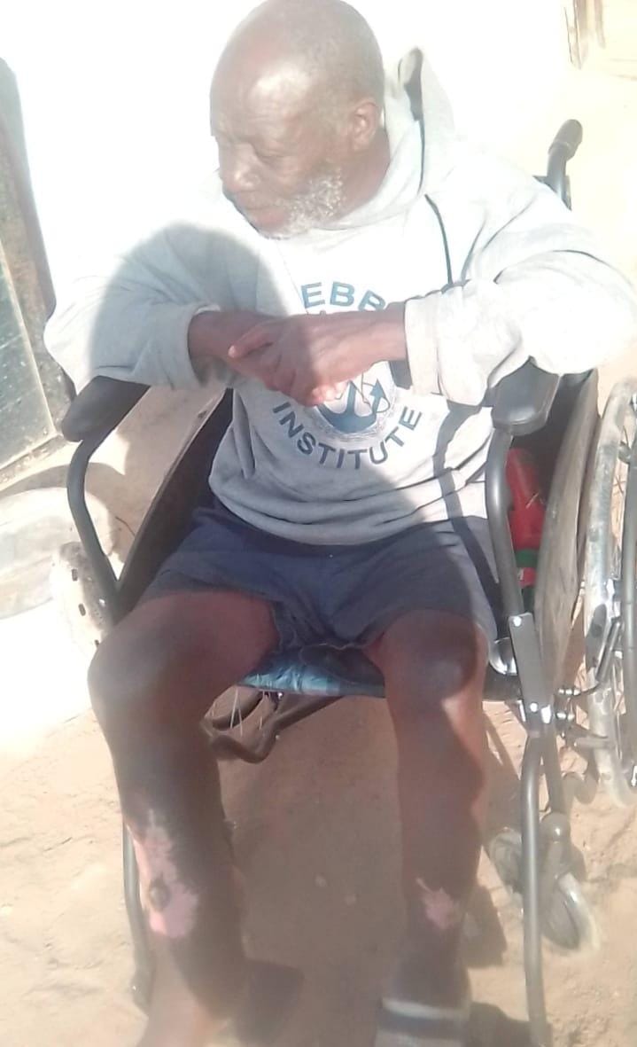 Family accuses Mpumalanga health department of neglect leading to grandfather’s leg rotting